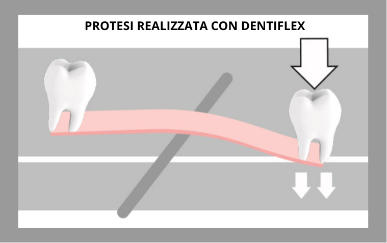 DENTIFLEX ROKO (2).png